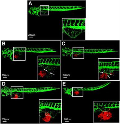 Replacement in angiogenesis research: Studying mechanisms of blood vessel development by animal-free in vitro, in vivo and in silico approaches